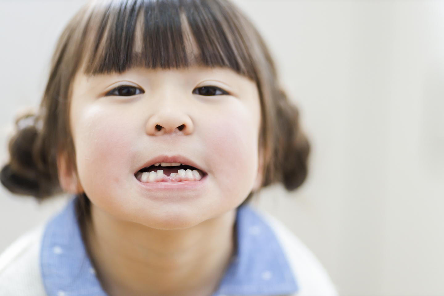 乳歯 子ども 子供 受け口 反対咬合 矯正 いつから マウスピース ムーシールド プレオルソ チンキャップ おすすめ 人気 安い 広島 矯正歯科