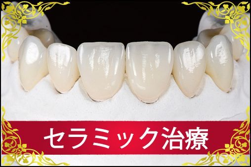 セラミック　ジルコニア　広島　歯科　歯医者　セラミック矯正